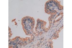 Used in DAB staining on fromalin fixed paraffin- embedded prostate gland tissue (NUP37 Antikörper  (AA 34-279))