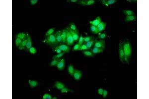 Immunofluorescence staining of HepG2 cells with ABIN7172059 at 1:100, counter-stained with DAPI. (THO Complex 5 Antikörper  (AA 2-53))