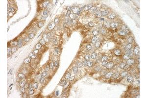 Immunohistochemistry (IHC) image for anti-Ankyrin Repeat and Sterile alpha Motif Domain Containing 1B (ANKS1B) (AA 245-268) antibody (ABIN7448954)