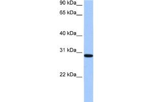 WB Suggested Anti-RALYL Antibody Titration:  0. (RALYL Antikörper  (C-Term))