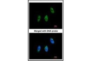 Immunofluorescence analysis of paraformaldehyde-fixed HeLa, using ELP3 antibody at 1/100 dilution. (ELP3/KAT9 Antikörper)