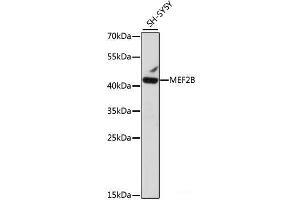 Western blot analysis of extracts of SH-SY5Y cells using MEF2B Polyclonal Antibody at dilution of 1:1000. (MEF2B Antikörper)
