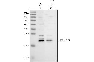 Western blot analysis of IL1RA using anti-IL1RA antibody (ABIN5518923).