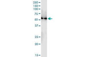 Immunoprecipitation of TUBB4Q transfected lysate using anti-TUBB4Q MaxPab rabbit polyclonal antibody and Protein A Magnetic Bead , and immunoblotted with TUBB4Q MaxPab mouse polyclonal antibody (B01) . (TUBB7P Antikörper  (AA 1-434))