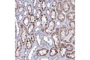 Immunohistochemical staining (Formalin-fixed paraffin-embedded sections) of human kidney with NUDT7 polyclonal antibody  shows strong cytoplasmic positivity in granular pattern in tubular cells. (NUDT7 Antikörper)