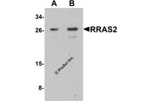 Western Blotting (WB) image for anti-Related RAS Viral (R-Ras) Oncogene Homolog 2 (RRAS2) (C-Term) antibody (ABIN1077448) (RRAS2 Antikörper  (C-Term))