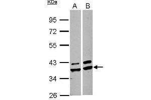 WB Image Sample (30 ug of whole cell lysate) A: A549 B: HepG2 10% SDS PAGE antibody diluted at 1:1000 (AKR1A1 Antikörper)