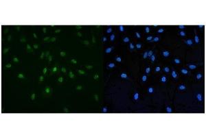 anti-Paf1, RNA Polymerase II Associated Factor, Homolog (PAF1) (AA 18-355) antibody