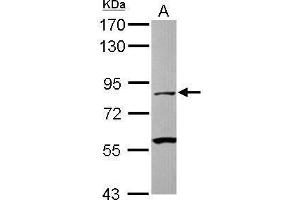 WB Image Sample (30 ug of whole cell lysate) A: Jurkat 7. (CAPN1 Antikörper)