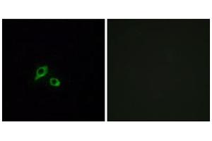 Immunofluorescence analysis of MCF-7 cells, using GIPR antibody. (GIPR Antikörper  (Internal Region))