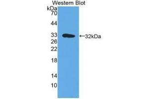 Detection of recombinant HLA-DRA using Polyclonal Antibody to HLA Class II Histocompatibility Antigen, DR Alpha Chain (HLA-DRA) (HLA-DRA Antikörper  (AA 25-216))