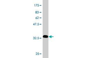 Western Blot detection against Immunogen (34. (CKS2 Antikörper  (AA 1-79))