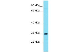 Host: Rabbit Target Name: C7orf57 Sample Type: Jurkat Whole Cell lysates Antibody Dilution: 1. (C7ORF57 Antikörper  (C-Term))