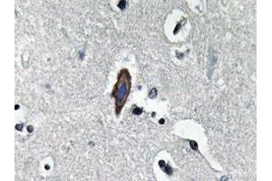 Immunohistochemistry analyzes of AP20629PU-N AQP0 antibody in paraffin-embedded human brain tissue. (MIP Antikörper)