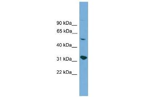 WB Suggested Anti-YIPF2 Antibody Titration:  0. (YIPF2 Antikörper  (Middle Region))