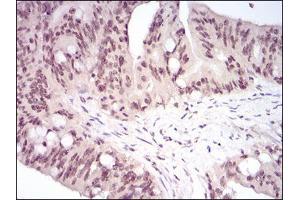 Immunohistochemistry (IHC) image for anti-Heat Shock Factor Protein 1 (HSF1) (AA 256-359) antibody (ABIN5542566)