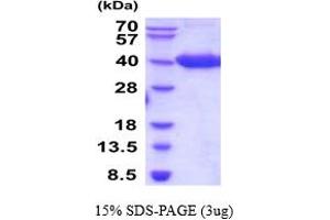 SDS-PAGE (SDS) image for Tumor Necrosis Factor Receptor Superfamily, Member 17 (TNFRSF17) (AA 1-54) protein (hIgG-His-tag) (ABIN5854473)