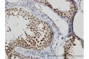 Immunoperoxidase of monoclonal antibody to CSE1L on formalin-fixed paraffin-embedded human testis. (Exportin 2 Antikörper  (AA 872-971))