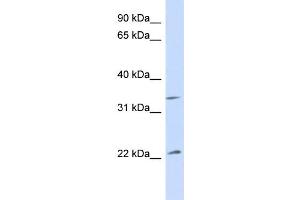WB Suggested Anti-ARF1 Antibody Titration: 1. (ARF1 Antikörper  (Middle Region))