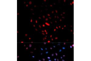 Immunofluorescence analysis of U2OS cells using Phospho-c-Jun(S73) Polyclonal Antibody