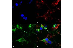 Immunocytochemistry/Immunofluorescence analysis using Mouse Anti-GABA-A Receptor Alpha 2 Monoclonal Antibody, Clone S399-19 (ABIN2485717). (GABRA1 Antikörper  (AA 350-385))