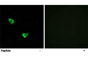 Immunofluorescence analysis of MCF-7 cells, using CHPF polyclonal antibody .