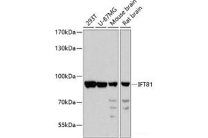 Western blot analysis of extracts of various cell lines using IFT81 Polyclonal Antibody at dilution of 1:3000. (IFT81 Antikörper)
