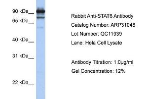 WB Suggested Anti-STAT6 Antibody Titration:  1 ug/ml  Positive Control:  Hela cell lysate STAT6 is strongly supported by BioGPS gene expression data to be expressed in Human HeLa cells (STAT6 Antikörper  (C-Term))