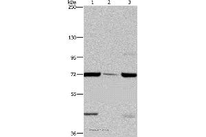 Western blot analysis of LoVo cell, human testis tissue and A549 cell, using FAAH Polyclonal Antibody at dilution of 1:400 (FAAH Antikörper)