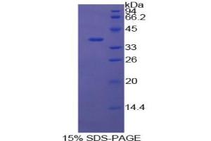 SDS-PAGE analysis of Cow Annexin V Protein.