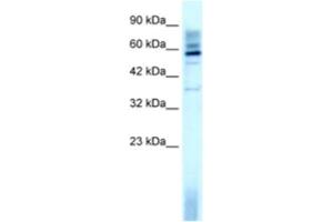 Western Blotting (WB) image for anti-TAF15 RNA Polymerase II, TATA Box Binding Protein (TBP)-Associated Factor, 68kDa (TAF15) antibody (ABIN2460174) (TAF15 Antikörper)