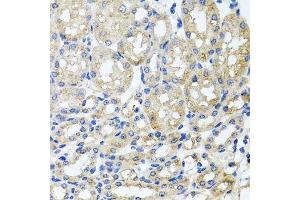 Immunohistochemistry of paraffin-embedded mouse kidney using ST8SIA2 antibody. (ST8SIA2 Antikörper  (AA 24-160))