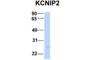 Host:  Rabbit  Target Name:  KCNIP2  Sample Type:  Human Fetal Brain  Antibody Dilution:  1. (KCNIP2 Antikörper  (N-Term))