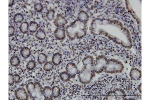 Immunoperoxidase of monoclonal antibody to MEF2A on formalin-fixed paraffin-embedded human small Intestine. (MEF2A Antikörper  (AA 71-170))