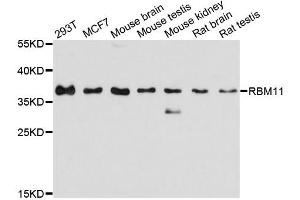 Western blot analysis of extracts of various cell lines, using RBM11 antibody. (RBM11 Antikörper)