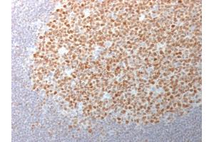 Formalin-fixed, paraffin-embedded human Tonsil stained with BCL-6 Mouse Monoclonal Antibody (BCL6/1982). (BCL6 Antikörper  (AA 256-389))
