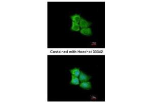 ICC/IF Image Immunofluorescence analysis of methanol-fixed A431, using PCMT1, antibody at 1:200 dilution. (PCMT1 Antikörper)