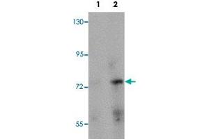 Western blot analysis of rat brain tissue with PIAS2 polyclonal antibody  at (Lane 1) 1 and (Lane 2) 2 ug/mL dilution. (PIAS2 Antikörper  (N-Term))