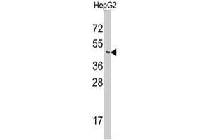 Western blot analysis of SNX6 polyclonal antibody  in HepG2 cell line lysates (35 ug/lane). (SNX6 Antikörper  (N-Term))