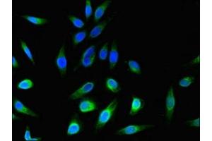 Immunofluorescent analysis of Hela cells using ABIN7174788 at dilution of 1:100 and Alexa Fluor 488-congugated AffiniPure Goat Anti-Rabbit IgG(H+L) (C1ORF189 Antikörper  (AA 1-101))