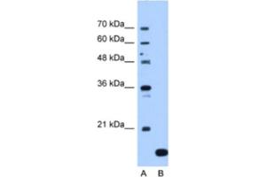 Western Blotting (WB) image for anti-N(alpha)-Acetyltransferase 50, NatE Catalytic Subunit (NAA50) antibody (ABIN2463235) (NAA50 Antikörper)