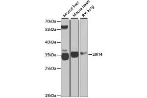 Western blot analysis of extracts of various cell lines, using SIRT4 antibody (ABIN2559931) at 1:1000 dilution. (SIRT4 Antikörper)