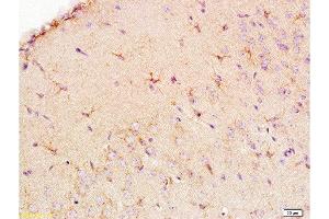 Formalin-fixed and paraffin embedded: rat brain tissue labeled with Anti-EAAT1/GLAST Polyclonal Antibody , Unconjugated at 1:200, followed by conjugation to the secondary antibody and DAB staining (SLC1A3 Antikörper  (AA 301-400))
