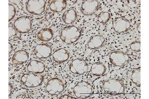 Immunoperoxidase of monoclonal antibody to QARS on formalin-fixed paraffin-embedded human colon. (QARS Antikörper  (AA 677-775))