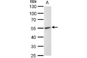 WB Image Desmin antibody detects Desmin protein by western blot analysis. (Desmin Antikörper)