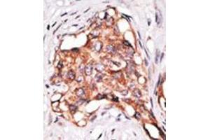 Image no. 2 for anti-Growth Differentiation Factor 3 (GDF3) (N-Term) antibody (ABIN357459)