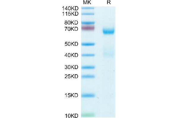 ADAM8 Protein (AA 17-658) (His tag)