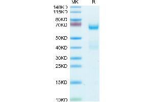 Mouse ADAM8 on Tris-Bis PAGE under reduced condition. (ADAM8 Protein (AA 17-658) (His tag))