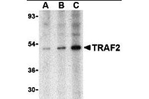 Western Blotting (WB) image for anti-TNF Receptor-Associated Factor 2 (TRAF2) (N-Term) antibody (ABIN1031639) (TRAF2 Antikörper  (N-Term))