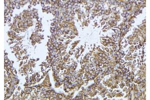 ABIN6276930 at 1/100 staining Mouse testis tissue by IHC-P. (GLB1 Antikörper  (Internal Region))